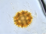 Pollen grain of Bothriocline subcordata, Joris, D87