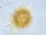 Pollen grain of Bothriocline subcordata, Joris, D87