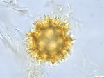 Pollen grain of Bothriocline subcordata, Joris, D87