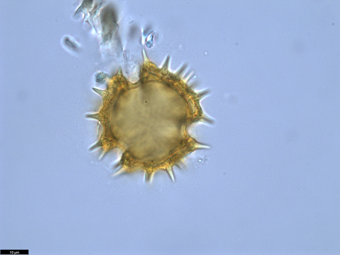 Pollen grain of Brenandendron donianum, Raimundo, A.F., Matos, G.C., Figueira, J.M., 361