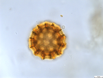 Pollen grain of Cabobanthus polysphaerus, Duvigneaud, 2914 V