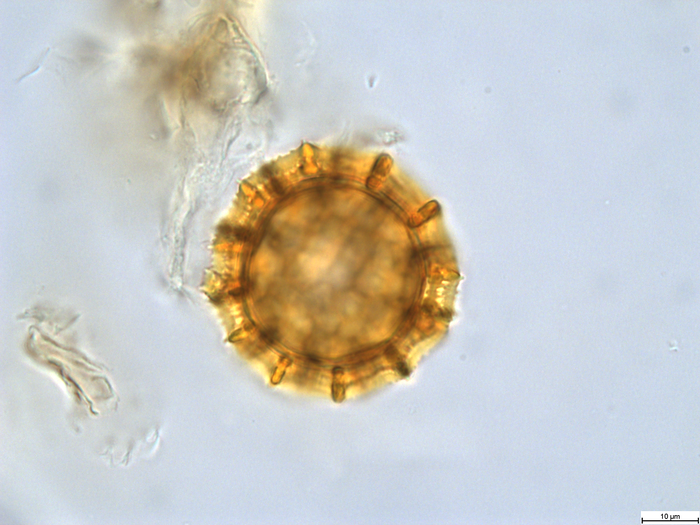 Pollen grain of Cabobanthus polysphaerus, Duvigneaud, 2914 V