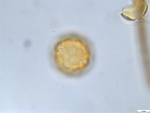 Pollen grain of Cabobanthus polysphaerus, Duvigneaud, 2914 V
