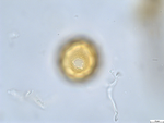 Pollen grain of Cabobanthus polysphaerus, Duvigneaud, 2914 V