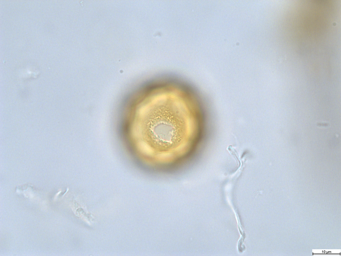 Pollen grain of Cabobanthus polysphaerus, Duvigneaud, 2914 V