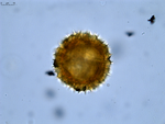 Pollen grain of Decastylocarpus perrieri, Perrier de la B?thie, H., 3435