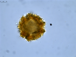 Pollen grain of Decastylocarpus perrieri, Perrier de la B?thie, H., 3435
