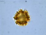 Pollen grain of Diaphractanthus homolepis, Perrier de la B?thie, H., 2102