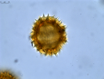 Pollen grain of Diaphractanthus homolepis, Perrier de la B?thie, H., 2102
