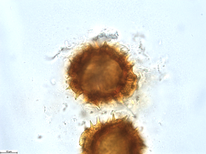Pollen grain of Gossweilera paludosa, Gossweiler, J., 7402