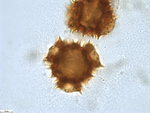Pollen grain of Gossweilera paludosa, Gossweiler, J., 7402