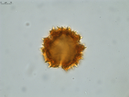 Pollen grain of Gymnanthemum andrangovalense, Humbert, H., Cours, G., 17956
