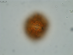 Pollen grain of Gymnanthemum coursii, Humbert, H. Saboureau, P., 31769