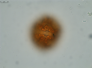 Pollen grain of Gymnanthemum coursii, Humbert, H. Saboureau, P., 31769