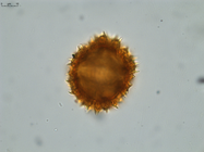 Pollen grain of Gymnanthemum coursii, Humbert, H. Saboureau, P., 31769