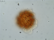 Pollen grain of Gymnanthemum coursii, Humbert, H. Saboureau, P., 31769
