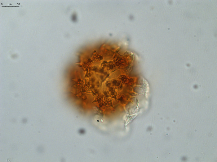 Pollen grain of Gymnanthemum coursii, Humbert, H. Saboureau, P., 31769