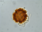 Pollen grain of Gymnanthemum coursii, Humbert, H. Saboureau, P., 31769