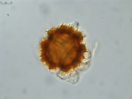 Pollen grain of Gymnanthemum coursii, Humbert, H. Saboureau, P., 31769