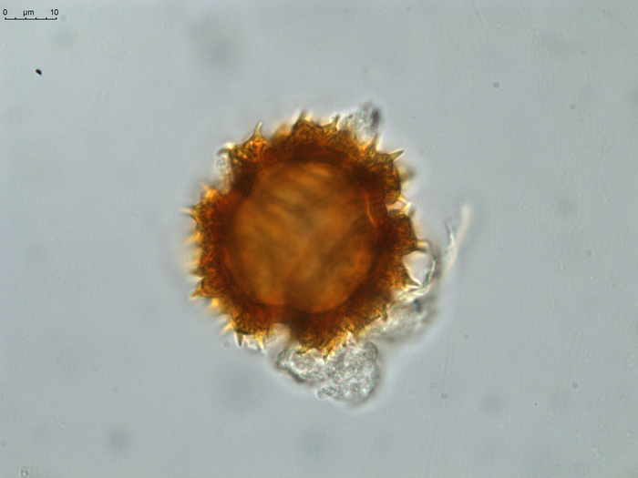 Pollen grain of Gymnanthemum coursii, Humbert, H. Saboureau, P., 31769