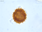 Pollen grain of Gymnanthemum pleistanthum, Humbert, H., 6915