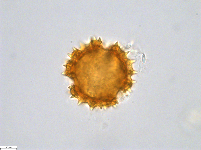 Polle grain of Omphalopappus newtonii, Murta, F. 75