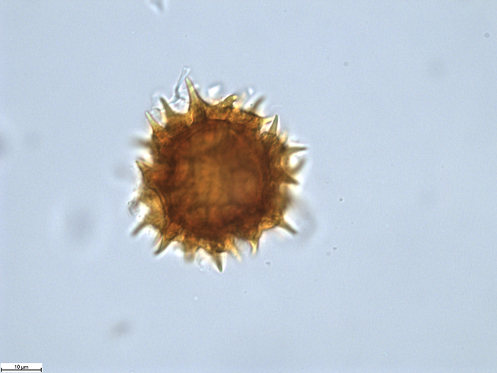 Polle grain of Omphalopappus newtonii, Mendes, E.J. 2504