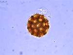 Pollen grain of Bothriocline madagascariensis, Perrier de la Bâthie, H., 2869