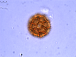Pollen grain of Bothriocline madagascariensis, Perrier de la Bâthie, H., 2869
