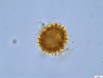 Pollen grain of Gymnanthemum thomsonianum, Meller, C.J., s.n.