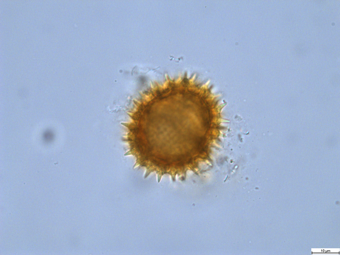 Pollen grain of Gymnanthemum thomsonianum, Meller, C.J., s.n.
