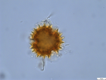 Pollen grain of Gymnanthemum thomsonianum, Meller, C.J., s.n.