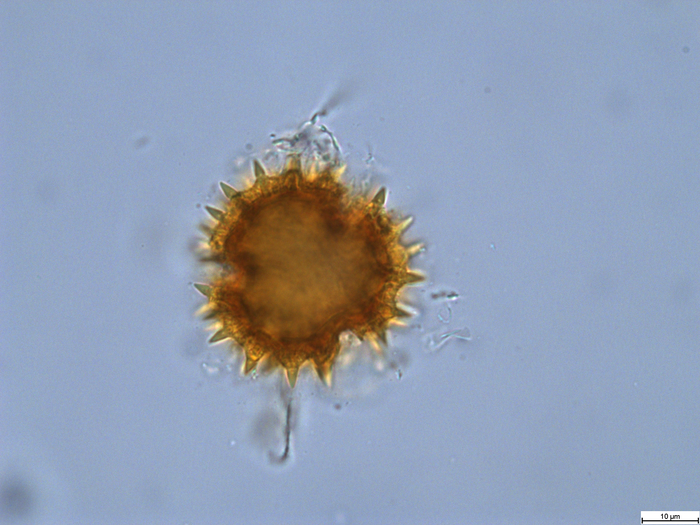 Pollen grain of Gymnanthemum thomsonianum, Meller, C.J., s.n.