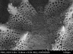 Pollen grain of Gymnanthemum thomsonianum, Meller, C.J., s.n.