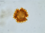 Pollen grain of Vernonia betsimisaraka, G. Cours, 4784