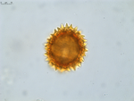 Pollen grain of Vernonia betsimisaraka, G. Cours, 4784