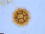 Pollen grain of Vernonia bractifimbriata, Gossweiler, J., s.n.