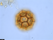 Pollen grain of Vernonia bractifimbriata, Gossweiler, J., s.n.