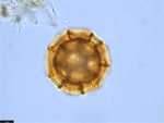 Pollen grain of Vernonia bractifimbriata, Gossweiler, J., 
