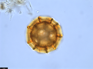 Pollen grain of Vernonia bractifimbriata, Gossweiler, J., 