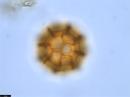 Pollen grain of Vernonia bractifimbriata, Gossweiler, J., 