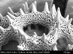 Pollen grain of Vernonia brideliifolia, Dubois L., 1131