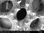 Pollen grain of Vernonia brideliifolia, Dubois L., 1131
