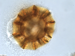 Pollen grain of Vernonia carnea, Welwitsch, F. M. J., 3288