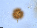 Pollen grain of Vernonia crassipetala, Menezes, O.J.A., 1874