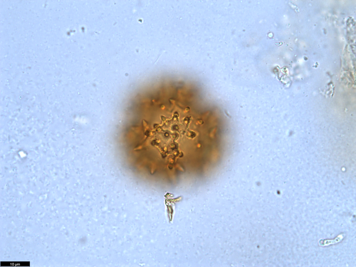 Pollen grain of Vernonia crassipetala, Menezes, O.J.A., 1874