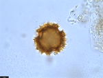 Pollen grain of Vernonia crassipetala, Menezes, O.J.A., 1874