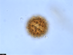 Pollen grain of Vernonia crassipetala, Menezes, O.J.A., 1874