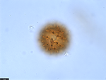 Pollen grain of Vernonia crassipetala, Menezes, O.J.A., 1874