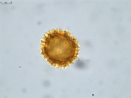 Pollen grain of Vernonia decaryana, R. Decary, 2799